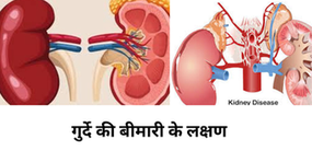 Kidney disease and its causes